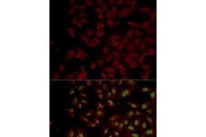 Immunofluorescence analysis of MCF7 cells using CCL25 Polyclonal Antibody (CCL25 抗体)