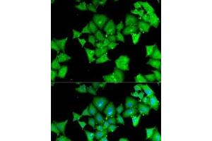 Immunofluorescence analysis of MCF7 cells using ACY1 Polyclonal Antibody (Aminoacylase 1 抗体)