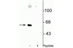 Western blot of HeLa cell lysate showing specific immunolabeling of the ~66 kDa Che-1 protein phosphorylated at Ser477 in the first lane (-). (AATF 抗体  (pSer477))