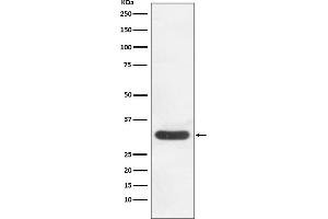 Western Blotting (WB) image for anti-Cyclin-Dependent Kinase 4 (CDK4) antibody (ABIN7606918)