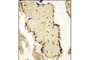 Formalin-fixed and paraffin-embedded placenta tissue reacted with SL2a Antibody (N-term) (ABIN390295 and ABIN2840733) , which was peroxidase-conjugated to the secondary antibody, followed by DAB staining. (SPPL2A 抗体  (N-Term))