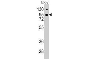 Western blot analysis of CDH7 polyclonal antibody  in K-562 cell line lysates (35 ug/lane). (Cadherin 7 抗体  (N-Term))
