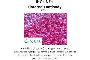 Image no. 1 for anti-Neurofibromin 1 (NF1) (Internal Region) antibody (ABIN1737327) (Neurofibromin 1 抗体  (Internal Region))
