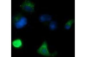 Image no. 2 for anti-Melan A (MLANA) antibody (ABIN1499427) (MLANA 抗体)