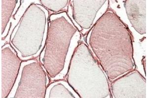 AP22425PU-N TRIM72 antibody staining of paraffin embedded Human Skeletal Muscle. (TRIM72 抗体  (Internal Region))
