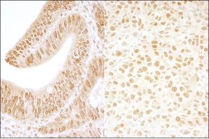 anti-Casein Kinase 2, beta (CSNK2B) (AA 100-150) antibody