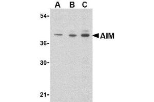 Image no. 1 for anti-CD5 Molecule-Like (CD5L) (N-Term) antibody (ABIN265123) (CD5L 抗体  (N-Term))