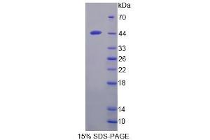 SDS-PAGE analysis of Rat BNIP3 Protein. (BNIP3 蛋白)
