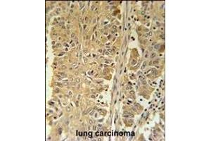 Immunohistochemistry (Paraffin-embedded Sections) (IHC (p)) image for anti-Phosphogluconate Dehydrogenase (PGD) (AA 236-265) antibody (ABIN651639)