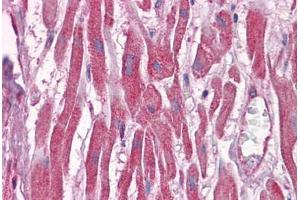 Human Heart: Formalin-Fixed, Paraffin-Embedded (FFPE) (DUSP6 抗体  (AA 1-382))
