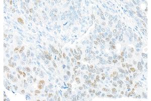 Immunohistochemistry (IHC) image for anti-Forkhead Box Q1 (FOXQ1) (AA 353-403) antibody (ABIN7455177)