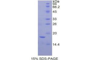 SDS-PAGE analysis of Human Amelogenin, X-Linked Protein. (AMELX 蛋白)
