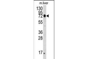 The anti-HS Pab (ABIN388133 and ABIN2846370) is used in Western blot to detect HS in mouse liver tissue lysate. (GRP78 抗体)