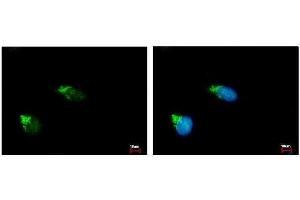 ICC/IF Image GALNT2 antibody [N1C1] detects GALNT2 protein at Golgi apparatus by immunofluorescent analysis. (GALNT2 抗体)