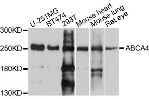 Western blot analysis of extracts of various cell lines, using ABCA4 antibody (ABIN5997165) at 1/1000 dilution. (ABCA4 抗体)