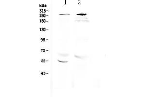 Western blot analysis of RanBP2 using anti-RanBP2 antibody .