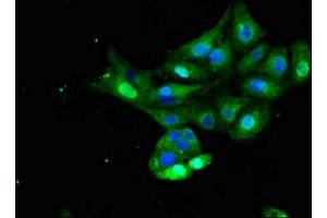 Immunofluorescent analysis of HepG2 cells using ABIN7156331 at dilution of 1:100 and Alexa Fluor 488-congugated AffiniPure Goat Anti-Rabbit IgG(H+L) (Insulin Receptor 抗体  (AA 1023-1298))