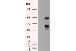 HEK293T cells were transfected with the pCMV6-ENTRY control (Left lane) or pCMV6-ENTRY SSB (Right lane) cDNA for 48 hrs and lysed. (SSB 抗体)