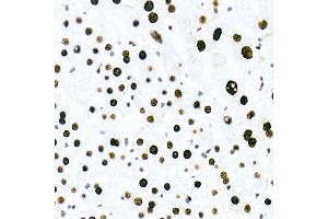 Immunohistochemistry of paraffin-embedded human liver using HNRNPM Rabbit mAb (ABIN7267635) at dilution of 1:100 (40x lens). (HNRNPM 抗体)