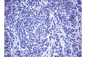 Image no. 2 for anti-Mdm2, p53 E3 Ubiquitin Protein Ligase Homolog (Mouse) (MDM2) (AA 119-438) antibody (ABIN1490872) (MDM2 抗体  (AA 119-438))