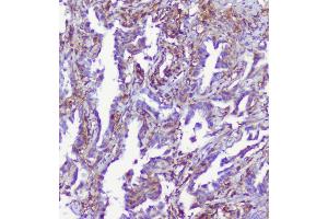 IHC analysis of RP2 using anti-RP2 antibody (ABIN6719513).