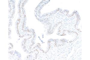 Immunohistochemistry (IHC) image for anti-Paired Box 8 (PAX8) (AA 225-275) antibody (ABIN7795777)