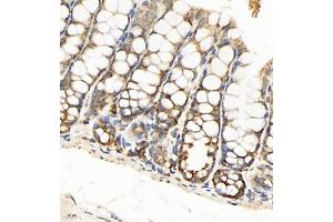 Immunohistochemistry of paraffin embedded mouse colon using SEC238 (ABIN7075521) at dilution of 1:650 (400x lens) (Sec23 Homolog B 抗体)