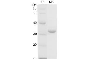 Western Blotting (WB) image for Galectin 3 (LGALS3) (Active) protein (His tag) (ABIN7320933) (Galectin 3 Protein (LGALS3) (His tag))