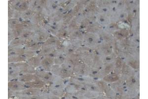 IHC-P analysis of Pig Cardiac Muscle Tissue, with DAB staining. (CKM 抗体  (AA 11-367))