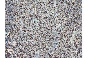 Image no. 11 for anti-SAM Domain and HD Domain 1 (SAMHD1) antibody (ABIN1500798)
