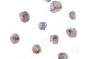 Immunocytochemistry of CARD8 in K562 cells with AP30184PU-N CARD8 antibody at 10 μg/ml. (CARD8 抗体)