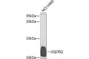 Western blot analysis of extracts of H460 cells using UQCRQ Polyclonal Antibody at dilution of 1:1000. (UQCRQ 抗体)
