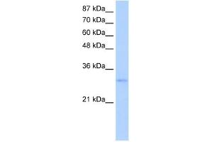 EXOSC6 antibody used at 5 ug/ml to detect target protein. (EXOSC6 抗体  (N-Term))