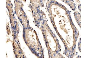 IHC analysis of SRP72 using anti-SRP72 antibody (ABIN7601648). (SRP72 抗体  (AA 40-460))