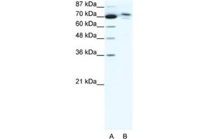 Western Blotting (WB) image for anti-Chromosome 14 Open Reading Frame 101 (C14orf101) antibody (ABIN2460921) (C14orf101 抗体)