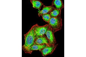Immunocytochemistry (ICC) image for anti-V-Akt Murine Thymoma Viral Oncogene Homolog 1 (AKT1) (AA 1-150) antibody (ABIN5856183)