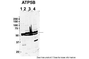 Western Blotting (WB) image for anti-ATP Synthase, H+ Transporting, Mitochondrial F1 Complex, beta Polypeptide (ATP5B) (C-Term) antibody (ABIN2783269)