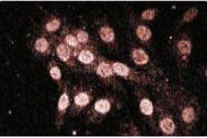 Immunofluorescence staining of L6 cells (Rat skeletal muscle myoblasts, ATCC CRL-1458). (NLRP2 抗体  (AA 620-732))