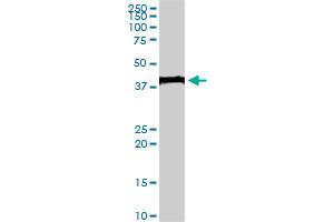 EVX1 monoclonal antibody (M07), clone 1B7. (EVX1 抗体  (AA 2-110))