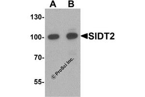 Western Blotting (WB) image for anti-SID1 Transmembrane Family, Member 2 (SIDT2) (N-Term) antibody (ABIN1077417) (SIDT2 抗体  (N-Term))