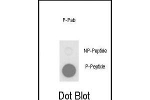 Dot blot analysis of anti-Phospho-PLB-T17 Phospho-specific Pab (ABIN650834 and ABIN2839801) on nitrocellulose membrane. (Phospholamban 抗体  (pThr17))