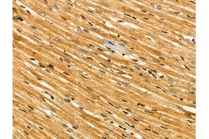 Phospho-Casein Kinase 1 alpha (Tyr294) Antibody at 1/100 staining Rat heart tissue by IHC-P. (CSNK1A1 抗体  (pTyr294))