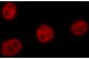ABIN6267423 staining HeLa by IF/ICC. (ELK1 抗体  (pSer383))