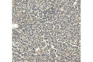 IHC analysis of Serum Amyloid P/APCS using anti-Serum Amyloid P/APCS antibody (ABIN5693182). (APCS 抗体  (AA 20-220))