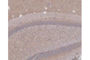 IHC analysis of Tau/MAPT using anti-Tau/MAPT antibody (ABIN7599268). (MAPT 抗体  (AA 1-322))