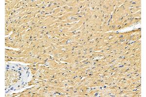 ABIN6260971 and ABIN6278349 at 1/100 staining Rat heart tissue by IHC-P.