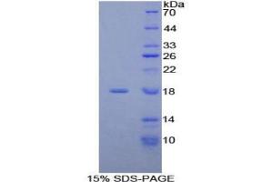 SDS-PAGE analysis of Human ACP Protein. (NDUFAB1 蛋白)