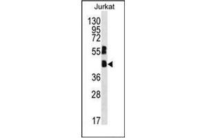 Western blot analysis of MAFB Antibody (C-term) in Jurkat cell line lysates (35ug/lane). (MAFB 抗体  (C-Term))