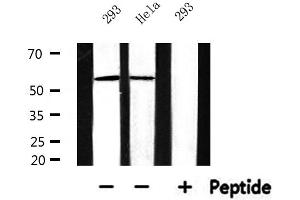 Western blot analysis of extracts from 293 and Hela, using Cytochrome P450 17A1 Antibody. (CYP17A1 抗体  (Internal Region))