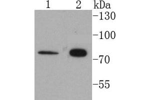Lane 1: 293T Cell lysates, Lane 2: HeLa cell lysates, probed with Cytokeratin 1 (1C2) Monoclonal Antibody  at 1:1000 overnight at 4˚C.